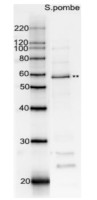 Rad22 | DNA repair and recombination protein rad22 (Saccharomyces pombe) in the group Antibodies Other Species / Fungi at Agrisera AB (Antibodies for research) (AS21 4554)